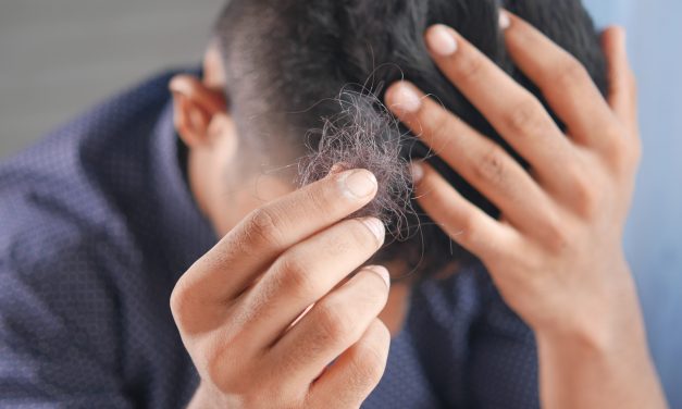 What Causes Hair Loss in Men and What Can You Do About It?